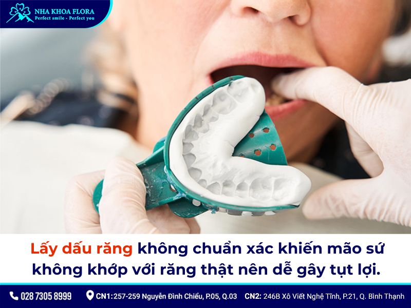 bọc răng sứ có bị tụt lợi không