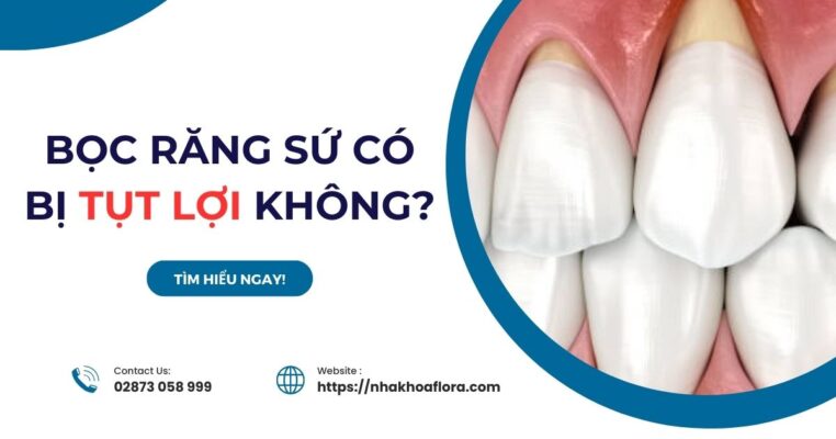 bọc răng sứ có bị tụt lợi không