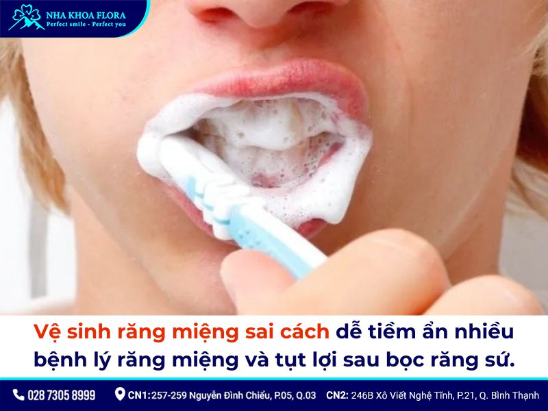 bọc răng sứ có bị tụt lợi không