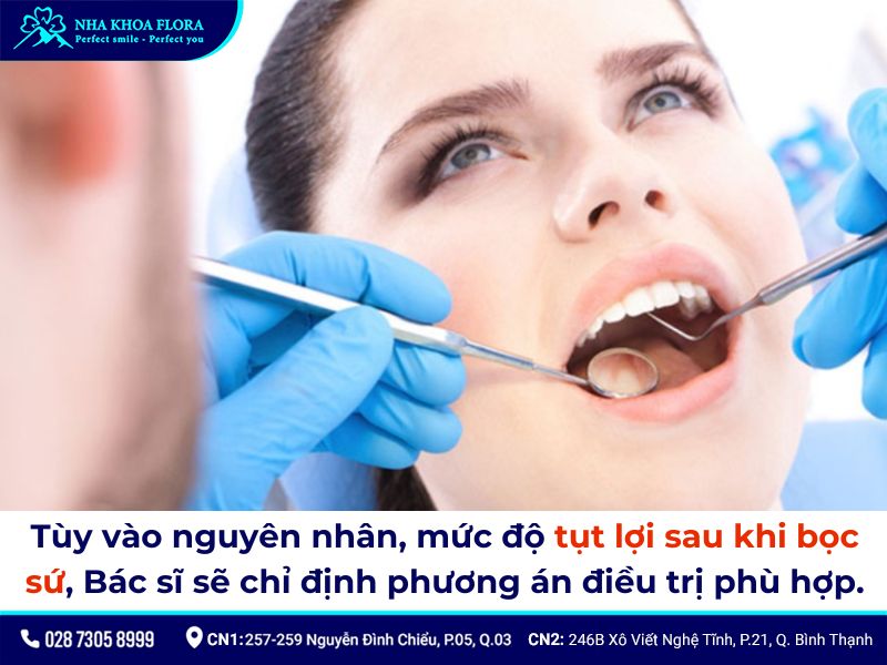 bọc răng sứ có bị tụt lợi không