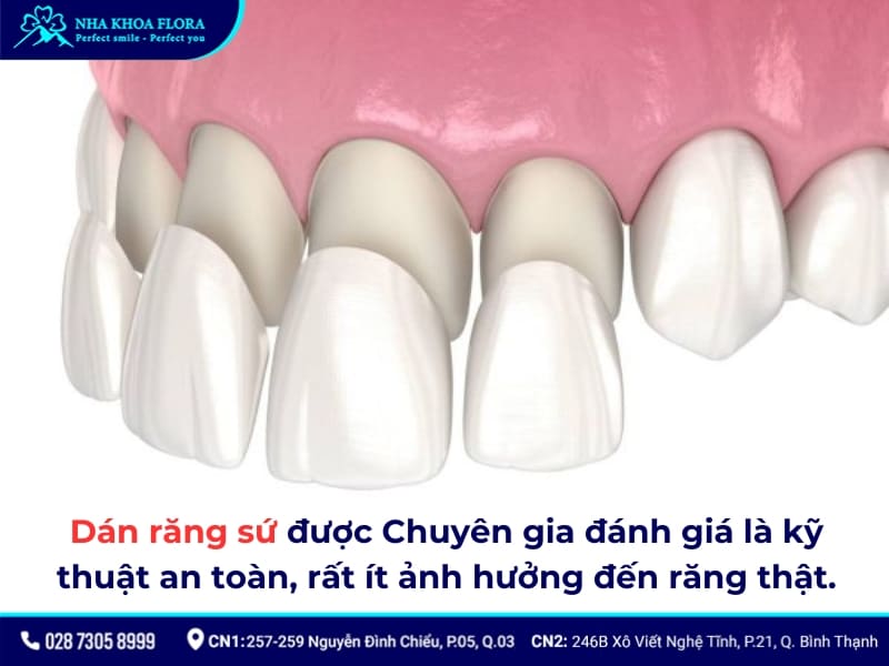 dán răng sứ có đau không