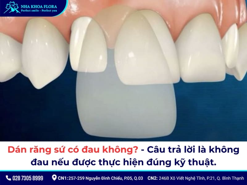 dán răng sứ có đau không