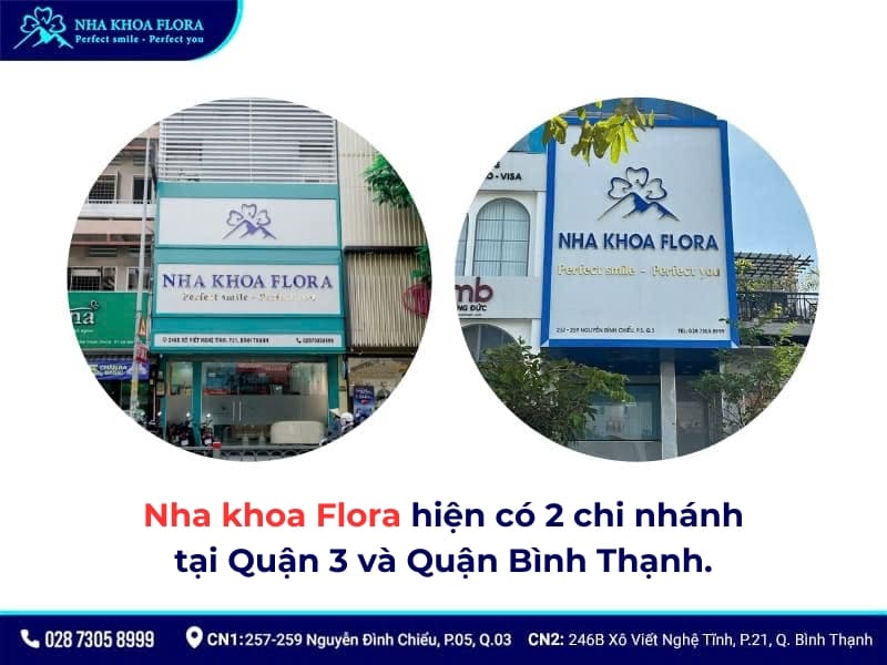 dán răng sứ veneer ở đâu tốt