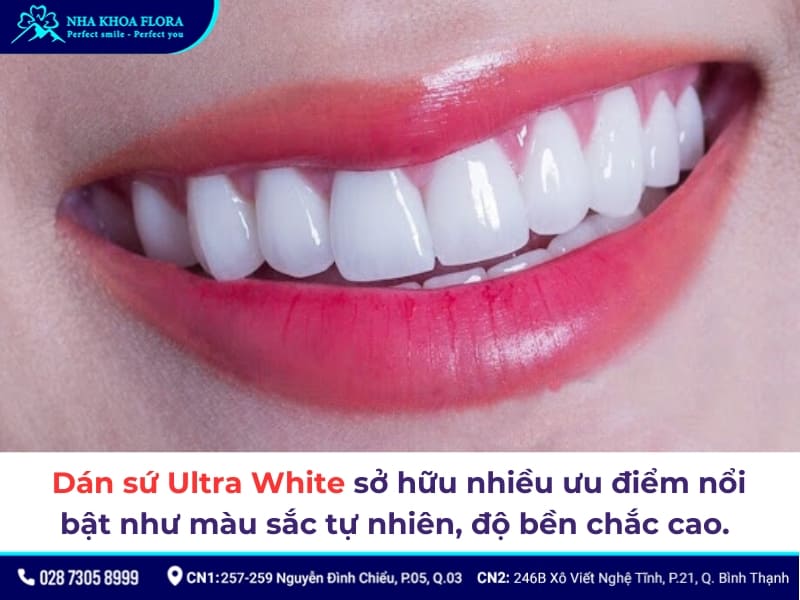 dán sứ ultra white