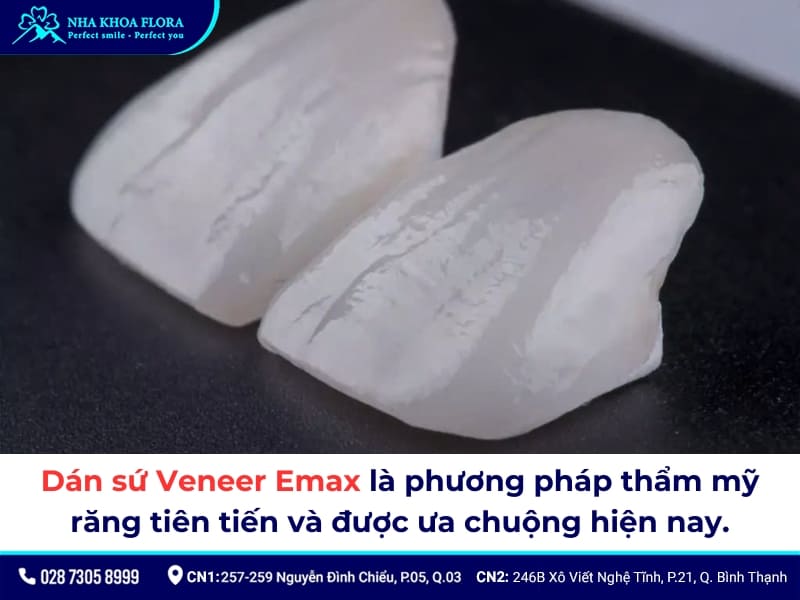dán sứ veneer emax