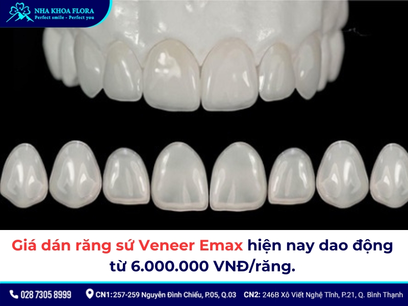 dán sứ veneer emax