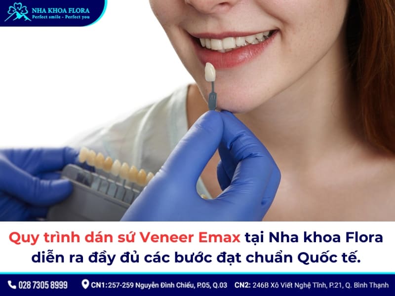 dán sứ veneer emax