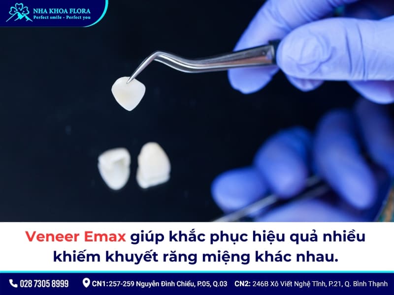 dán sứ veneer emax