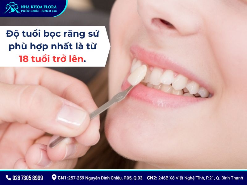 độ tuổi bọc răng sứ