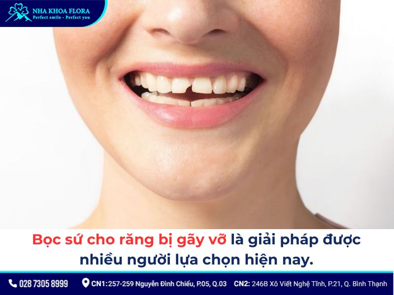 độ tuổi bọc răng sứ