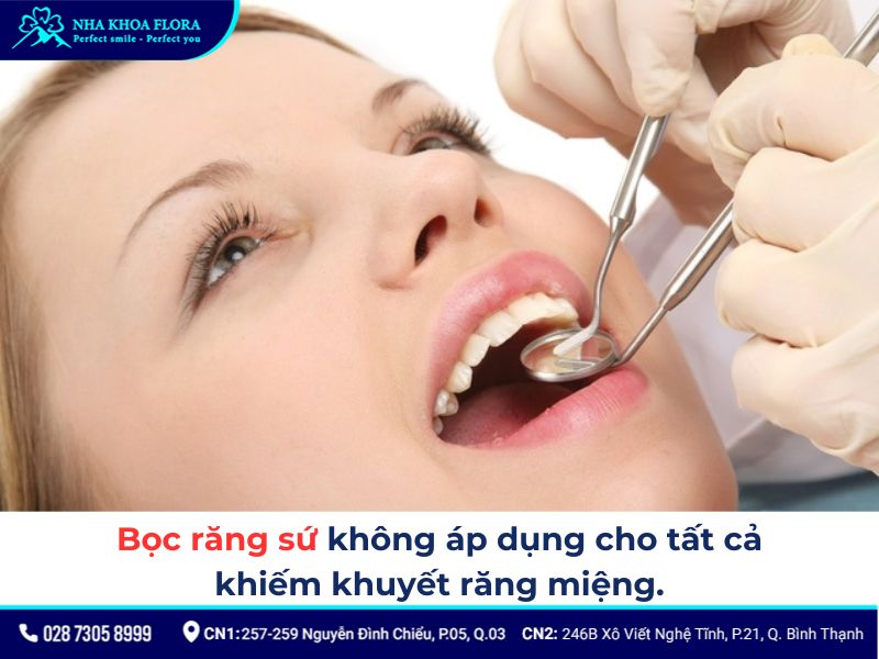 độ tuổi bọc răng sứ