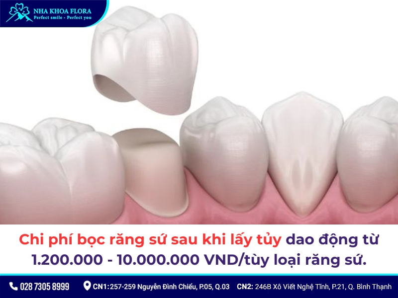 lấy tủy bọc răng sứ giá bao nhiêu