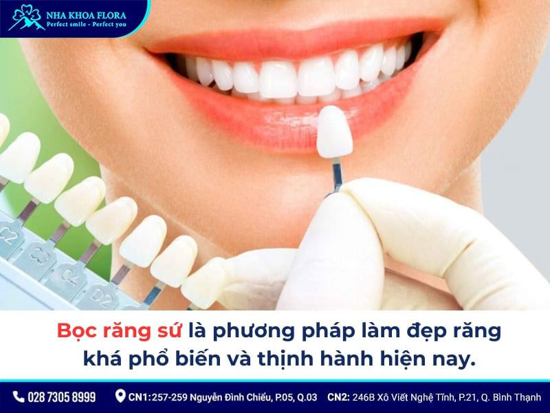 nên niềng răng hay bọc sứ