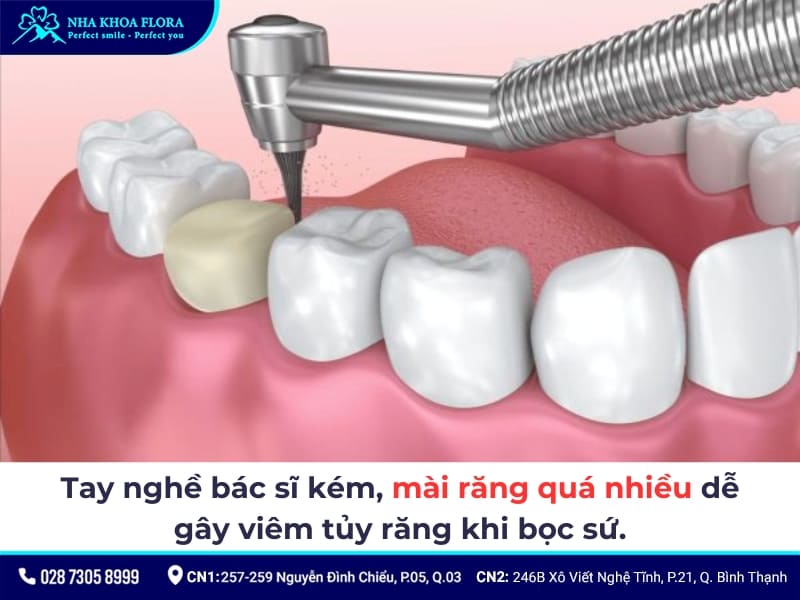 răng bọc sứ bị viêm tủy