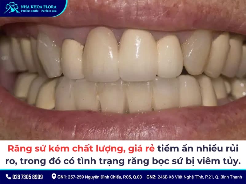răng bọc sứ bị viêm tủy