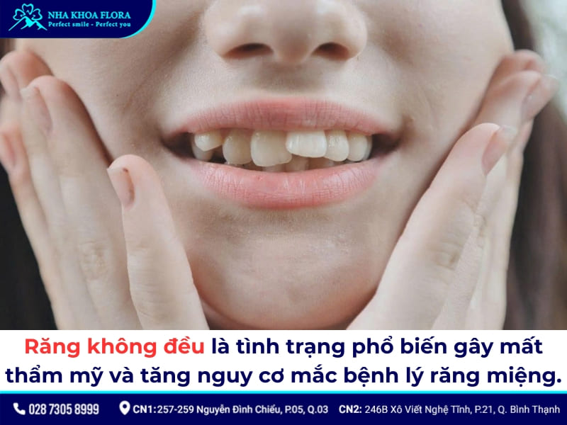 răng không đều có dán sứ được không