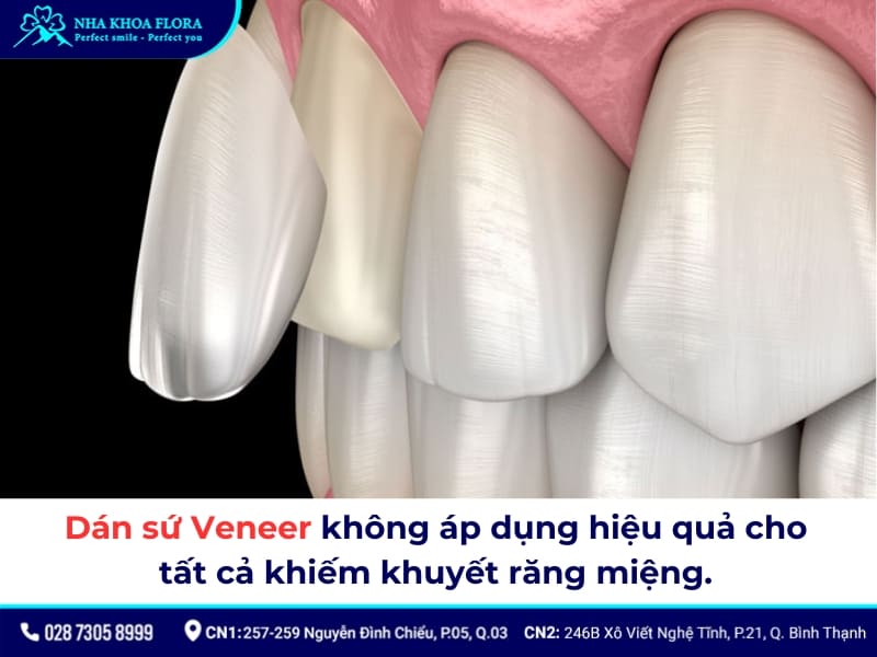 răng sâu có dán sứ được không