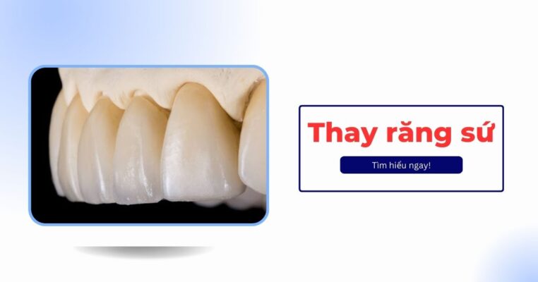 thay răng sứ