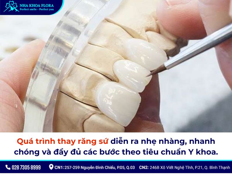 thay răng sứ