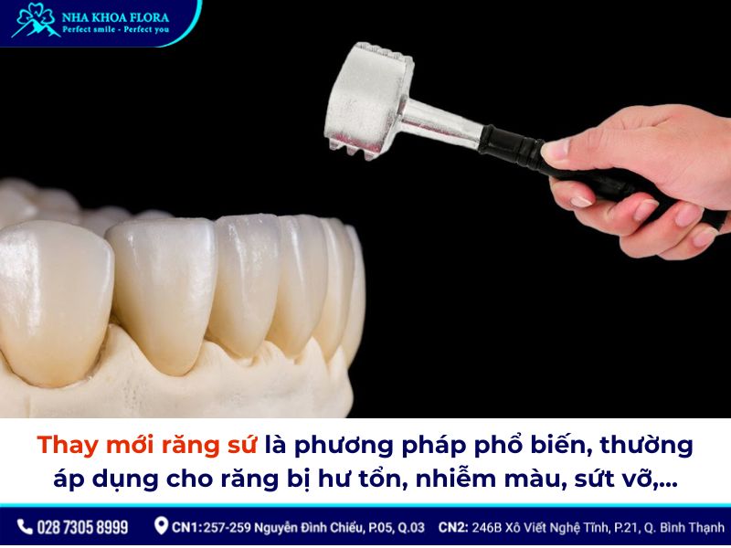 thay răng sứ