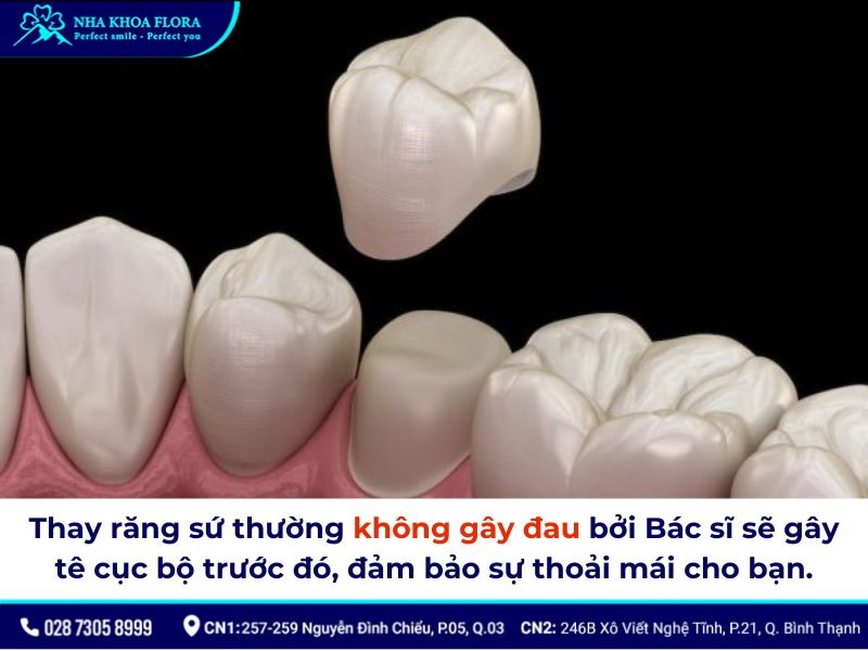 thay răng sứ