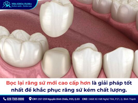 Bọc răng sứ 500k - ảnh 3