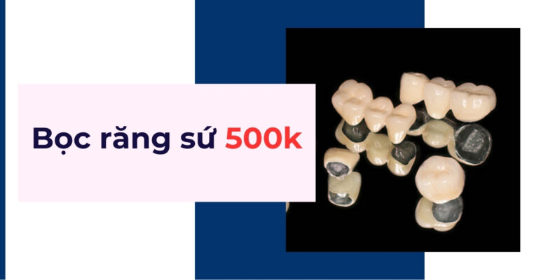 Bọc răng sứ 500k