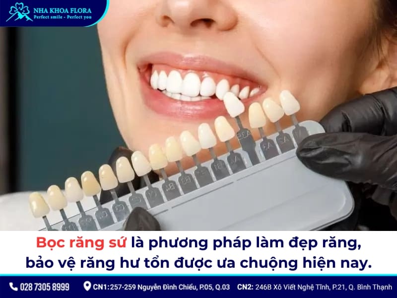 bọc răng sứ