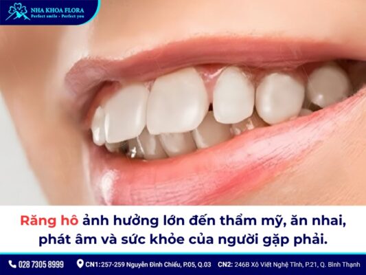 Bọc răng sứ có hết hô không? - ảnh 3