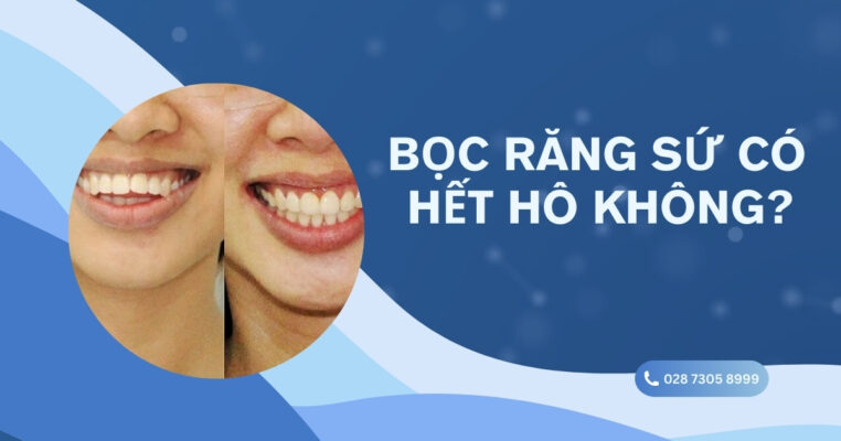 Bọc răng sứ có hết hô không