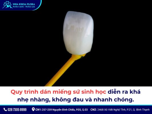 Bọc răng sứ sinh học - ảnh 3