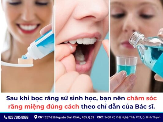 Bọc răng sứ sinh học - ảnh 5
