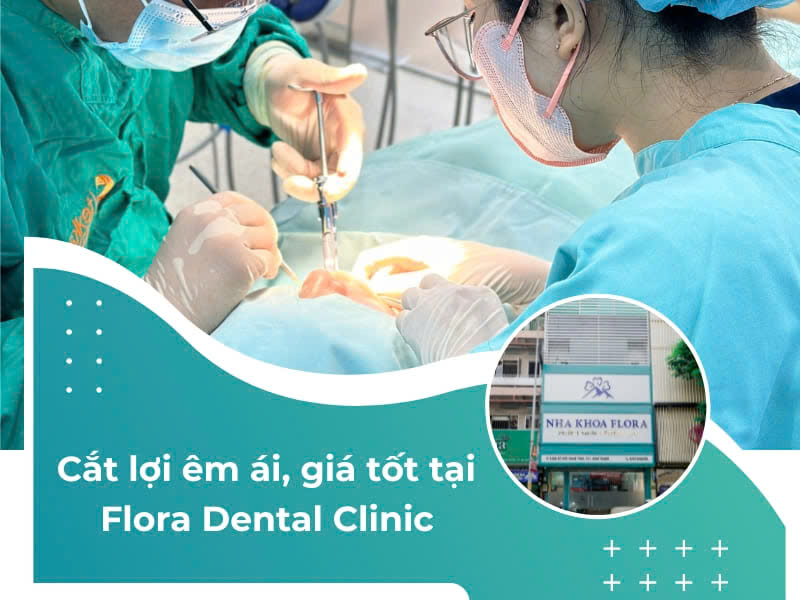 chi phí cắt lợi