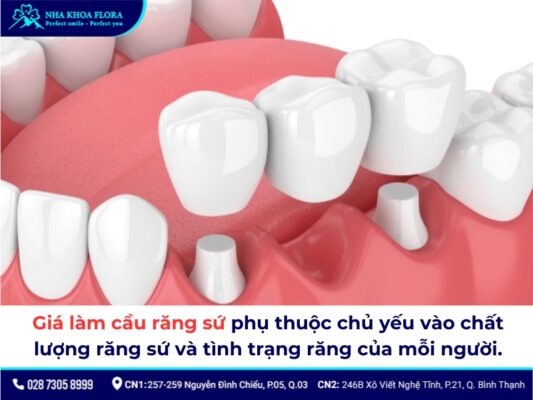 Chi phí làm cầu răng sứ - ảnh 2