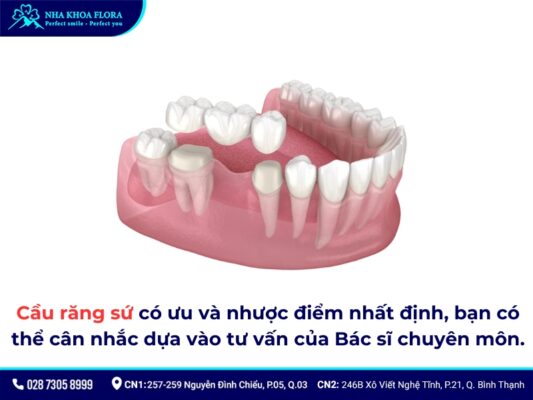 Chi phí làm cầu răng sứ - ảnh 3