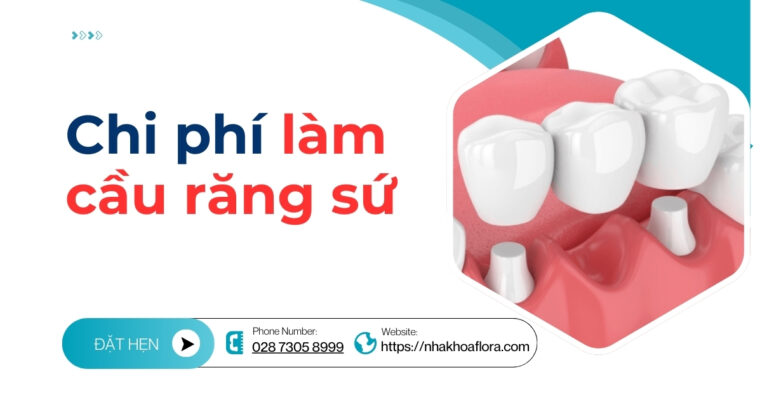 Chi phí làm cầu răng sứ
