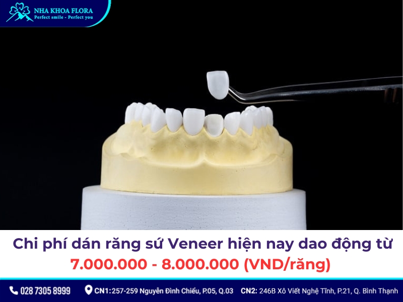 dán sứ veneer
