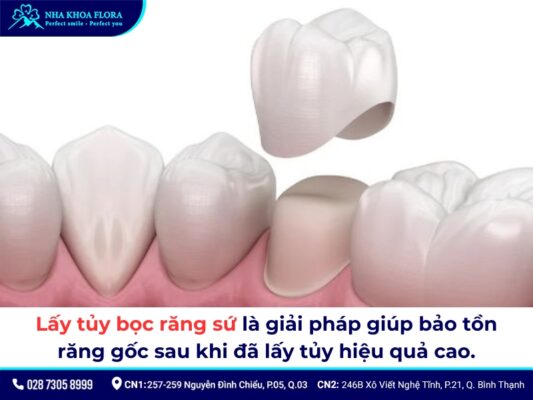 Lấy tủy bọc răng sứ mất bao lâu? Quy trình, giá bao nhiêu? 3