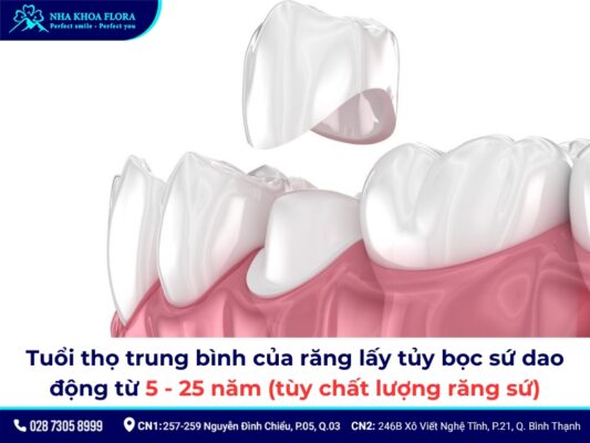 Lấy tủy bọc răng sứ mất bao lâu? Quy trình, giá bao nhiêu? 6