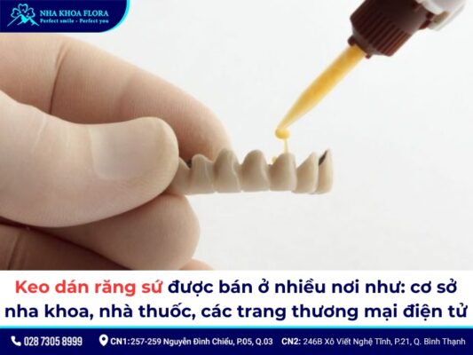 Mua keo dán sứ ở đâu? - ảnh 1