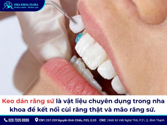Mua keo dán sứ ở đâu? - ảnh 2