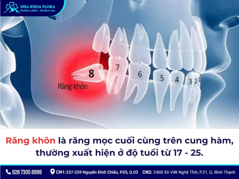 nhổ răng khôn