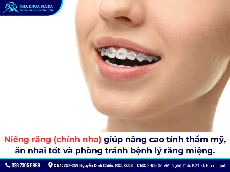 niềng răng