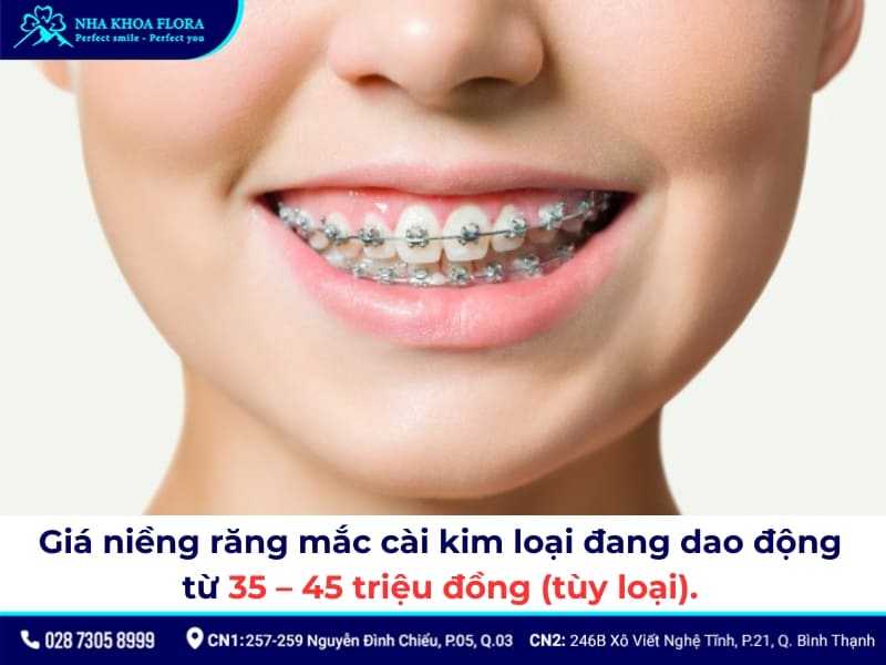 niềng răng bao nhiêu tiền