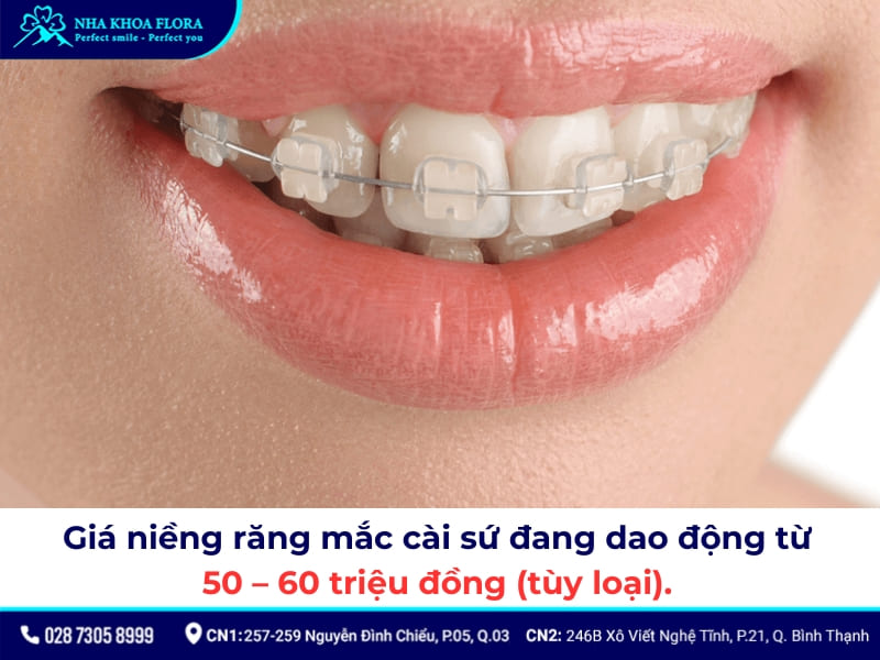 niềng răng bao nhiêu tiền