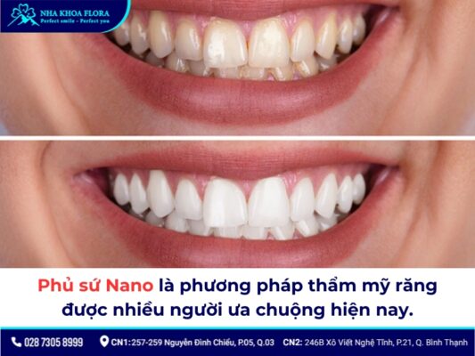 Phủ sứ Nano là gì, giá bao nhiêu và các vấn đề bạn nên biết! 1