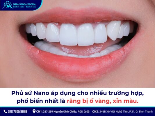 Phủ sứ Nano là gì, giá bao nhiêu và các vấn đề bạn nên biết! 2
