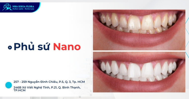 Phủ sứ Nano