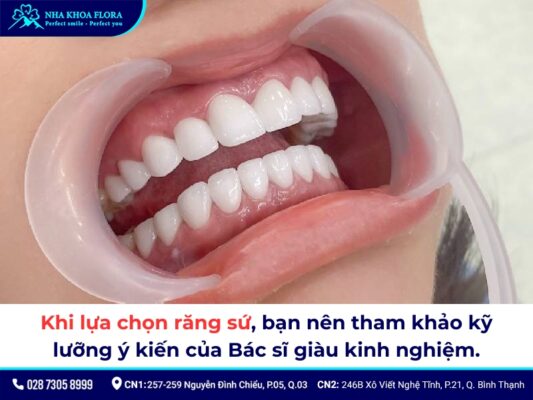 Răng sứ 800k - ảnh 4