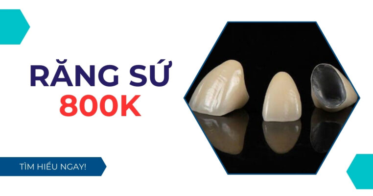 Răng sứ 800k